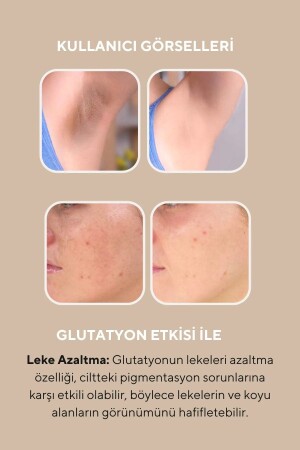 2'li Cilt Beyazlatıcı Aydınlatıcı Glutatyonlu Leke Karşıtı Krem Niacinamide & Kojik Asitli 50 ml - 5