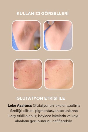 Cilt Beyazlatıcı Aydınlatıcı Glutatyonlu Leke Karşıtı Krem Kolajen- Niacinamide & Kojik Asitli 50 ml - 7