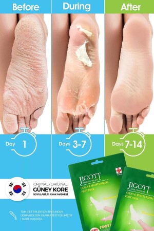 Çorap Tipi Soyulan Ayak Peeling Maskesi - Miracle Foot Peeling Pack - 2