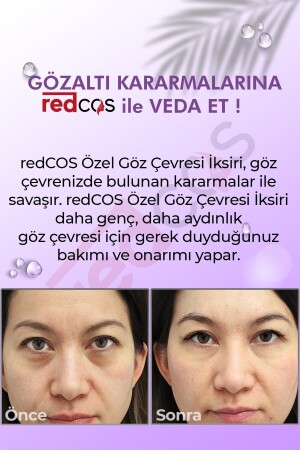 Gözaltı Bakım Iksiri Nemlendirici- Dengeleyici- Yorgun Görünüm- Morluk Giderici - Under-eye Elixir - 4