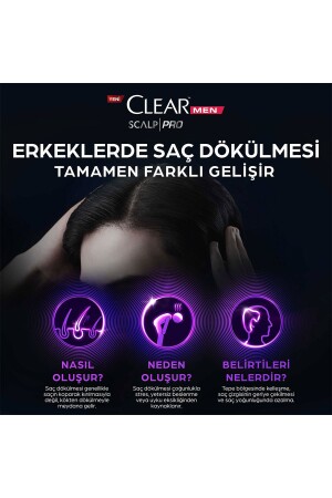 Men Scalp Pro Güçlendirici Şampuan Saç Dökülmesine Kepeğe Karşı Etkili 300 ml Serum 70 ml - 9