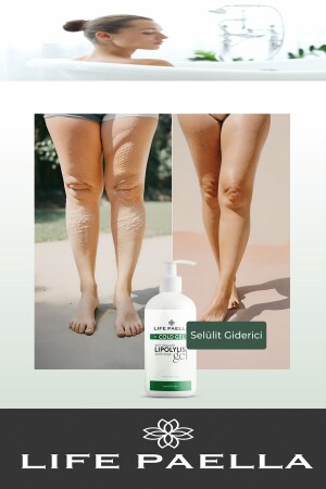 Professionelles Anti-Cellulite- und Dehnungsstreifen-Gel mit kalter Lipolyse zur regionalen Gewichtsabnahme, 250 ml - 9