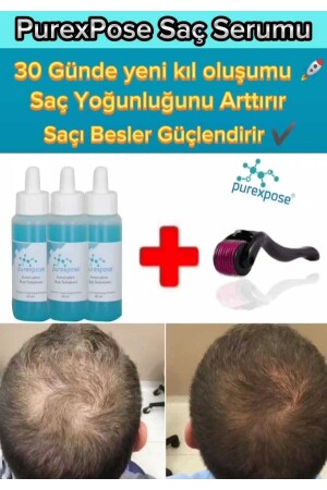 Saç Bakım Saç Çıkarmaya Yardımcı Onarıcı Uzatıcı Besleyici Serum 3 1 Dermaroller 9145455876745 - 3