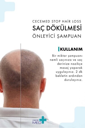 Saç Dökülmesi Önleyici Şampuan 300 Ml - 5