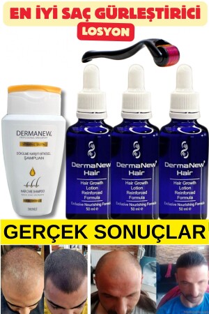 Saç gürleştirici - sac - sac bakimi -sac serumu - sac serum ve yagi - sac - 3 Adet-Roller-Şampuan - 3