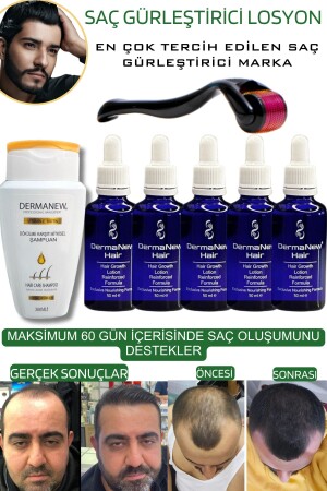 Saç Gürleştirici Serum Roller Mavi Şampuan Hediyeli - -5x50ml - 3