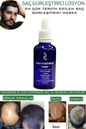 Saç Gürleştirici Serum Roller Mavi Şampuan Hediyeli - -5x50ml - 6