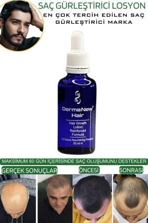 Saç Gürleştirici Serum Roller Mavi Şampuan Hediyeli - -5x50ml - 7