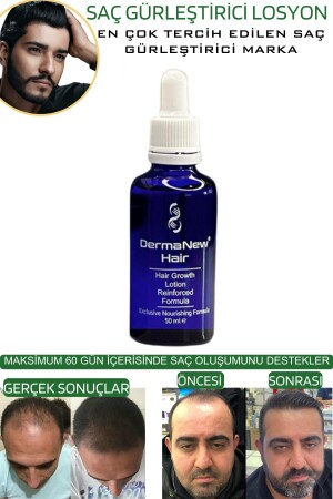 Saç Gürleştirici Serum Roller Mavi Şampuan Hediyeli - -5x50ml - 8