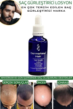 Saç Gürleştirici Serum Roller Mavi Şampuan Hediyeli - -5x50ml - 9