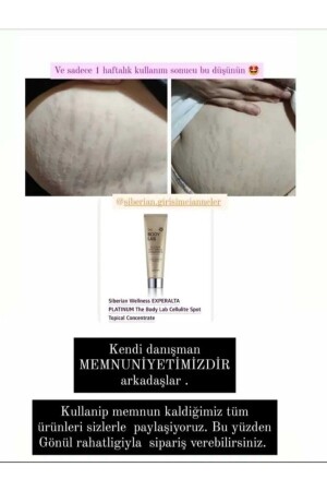 Siberian Wellness Body Lab Cellulite-Straffungscreme - 5