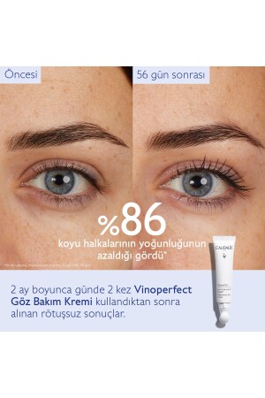 Vinoperfect Göz Bakım Kremi 15 ml - 5