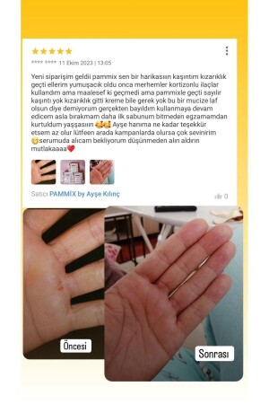 Yenileyici Botox Sabunu (1 Adet) - 5